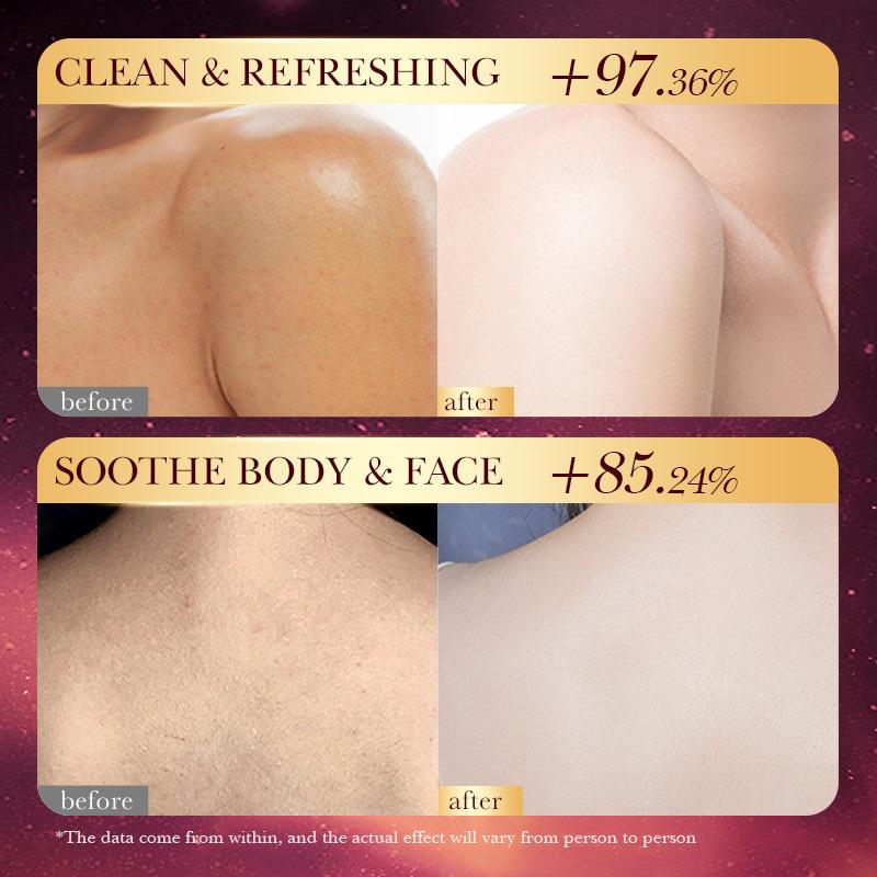 Luxury Rose Skincare - SADOER Essential Oil Soap Rose Cherry